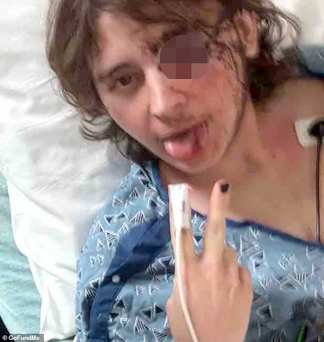 ICE Protester Allegedly Left Blind in Santa Ana Incident, Prompting Debate on Force Use