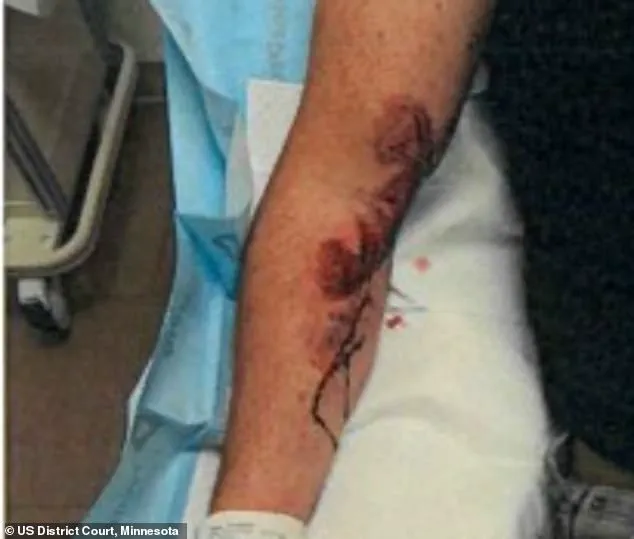 ICE Officer Jonathan Ross Dragged Over 360 Feet by Illegal Immigrant Roberto Carlos Munoz in June 2024 Incident
