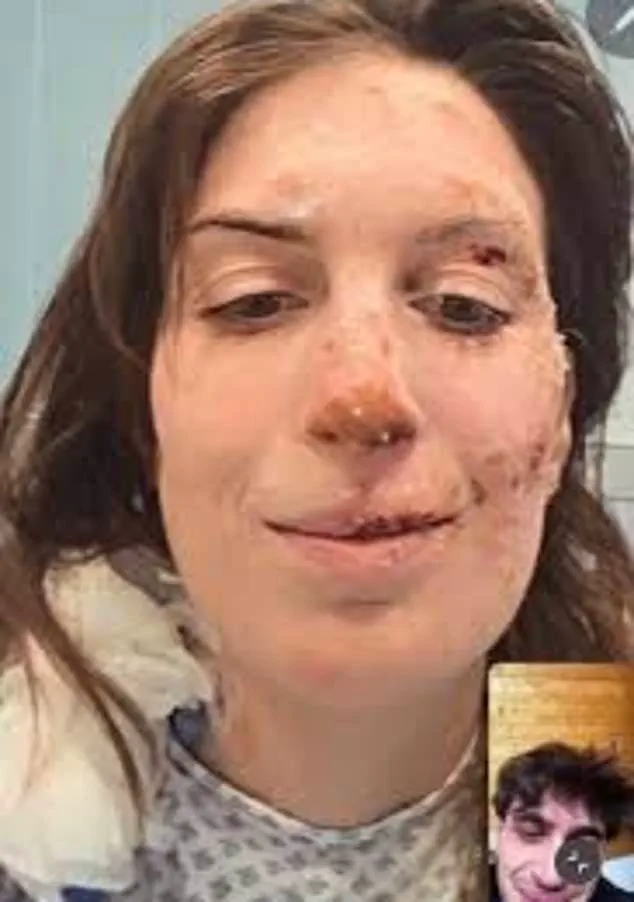 Eleonora Palmieri's Ordeal: Surviving the Crans-Montana Nightclub Fire and Its Lasting Impact