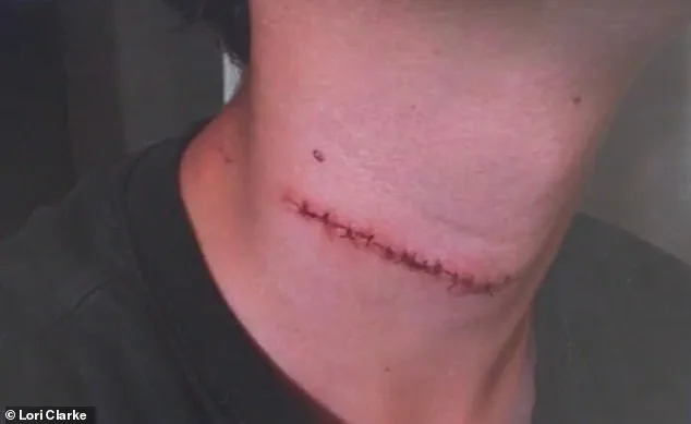 Daytona Beach Boardwalk Horror: System Failed to Protect Teen from Brutal Attack