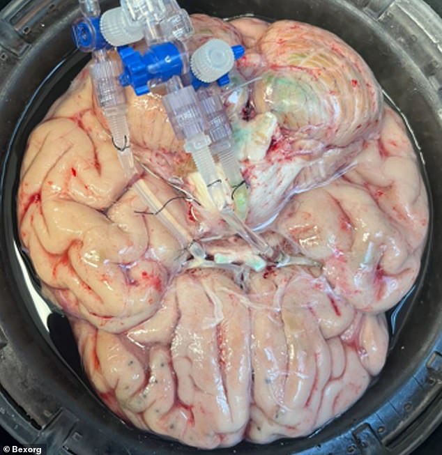 Startup Bexorg Keeps Human Brains Alive for Drug Testing