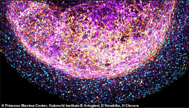 Startup Bexorg Keeps Human Brains Alive for Drug Testing