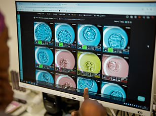 Startup Bexorg Keeps Human Brains Alive for Drug Testing
