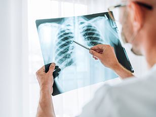 Groundbreaking urine test could detect lung cancer years before symptoms appear.